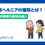 椎間板ヘルニアの種類とは?部位別の特徴や症状の違いを分かりやすく解説