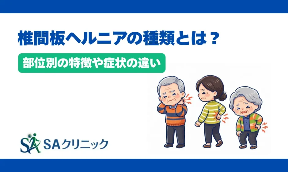 椎間板ヘルニアの種類とは？部位別の特徴や症状の違いを分かりやすく解説